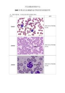 2009年第2次血细胞形态学检查室间质量评价