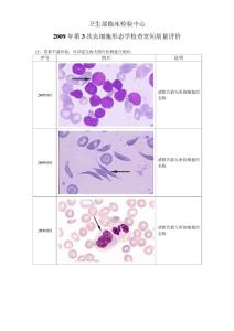 2009年第3次血细胞形态学检查室间质量评价