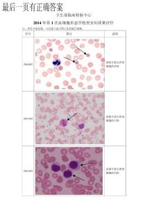 2014年第1次血细胞形态学检查室间质评