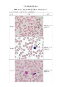2015年第3次血细胞形态学检查室间质量评价.