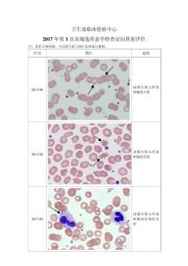 2017年第1次血细胞形态学检查室间质量评价