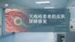 天疱疮患者的皮肤屏障修复