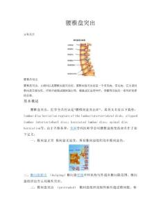 腰椎盘突出