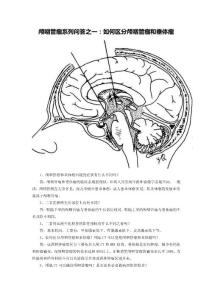顱咽管瘤系列問答之一：如何區分顱咽管瘤和垂體瘤