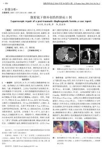 腹腔鏡下修補(bǔ)創(chuàng)傷性膈疝1例
