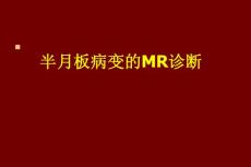 半月板病變mr診斷85142596