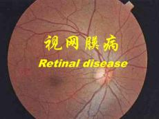 视网膜病医学课件