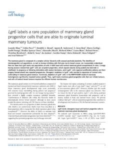 ncb3434-Lgr6 labels a rare population of mammary gland progenitor cells that are able to originate luminal mammary tumours