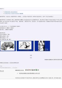 專題講座】腕舟骨骨折 [精華]