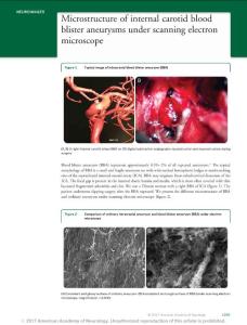 microstructure of internal carotid blood blister aneurysms under scanning electron microscope.[2017][neurology][10.1212w.微观结构的扫描电子显微镜下颈内动脉瘤血疱。[2017](神经
