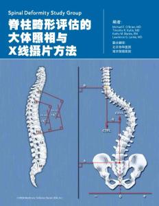 脊柱畸形评估的大体照相与X线摄片方法 - 北京协和医院.pdf