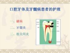 口腔牙体牙髓病的护理