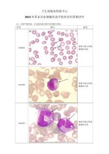 2014年第2次血细胞形态学检查室间质量评价