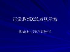 正常胸部x線表現(xiàn)