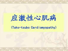 应激性心肌病