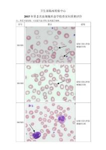 2015年第2次血細胞形態學檢查室間質量評價
