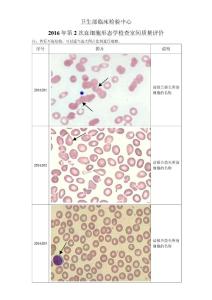 2016年第2次血细胞形态学检查室间质量评价