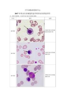 2017年第2次血细胞形态学检查室间质量评价
