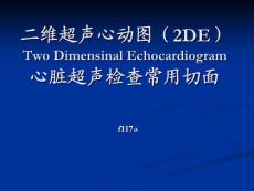 二維超聲心動圖