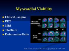 核心臟病學現狀與進展第二講_PPT課件