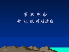 带状疱疹ppt课件