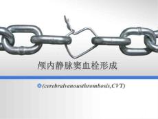 颅内静脉窦血栓形成ppt课件