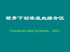 锁骨下动脉盗血综合征-ppt课件