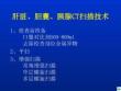 肝胆胰的ct表现ppt课件