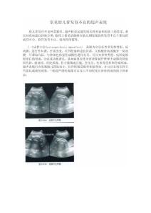 常見胎兒骨發育不良的超聲表現