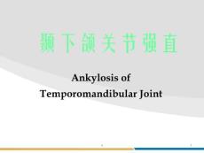 颞下颌关节强直