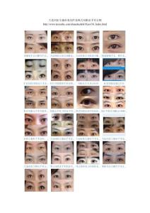 大連何醫(yī)生整形美容經(jīng)典韓式雙眼皮手術(shù)實例