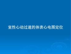 室性心动过速的体表心电图定位