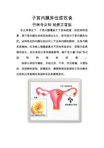 子宫内膜异位症饮食