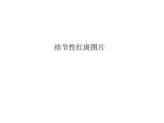 《结节性红斑图片》