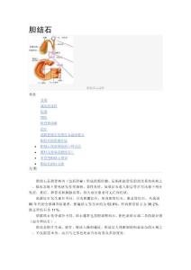 胆结石知识
