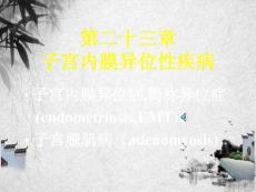子宫内膜异位症
