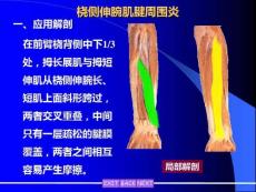 桡侧伸腕肌腱周围炎