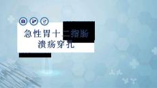急性胃十二指肠溃疡穿孔
