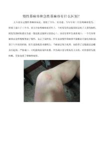 慢性荨麻疹与急性荨麻疹,一招轻松搞定