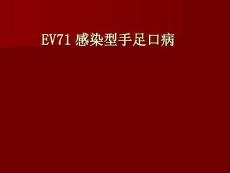 肠道病毒71型感染1266(共43张PPT)