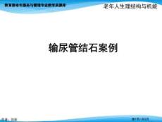 输尿管结石案例PPT