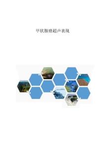 甲状腺癌超声表现