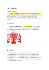 子宫腺肌病
