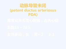 动脉导管未闭