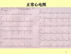經(jīng)典心電圖實用手冊【實用查詢+快速記憶】 PPT課件