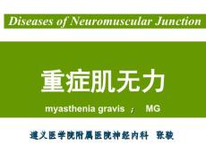重症肌无力 资料