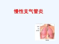 慢性支气管炎