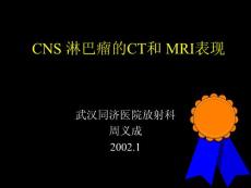 CNS_淋巴瘤的CT和_MRI表现