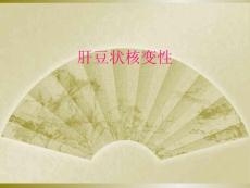 肝豆状核变性