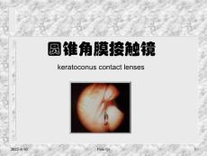 圆锥角膜镜片ppt课件